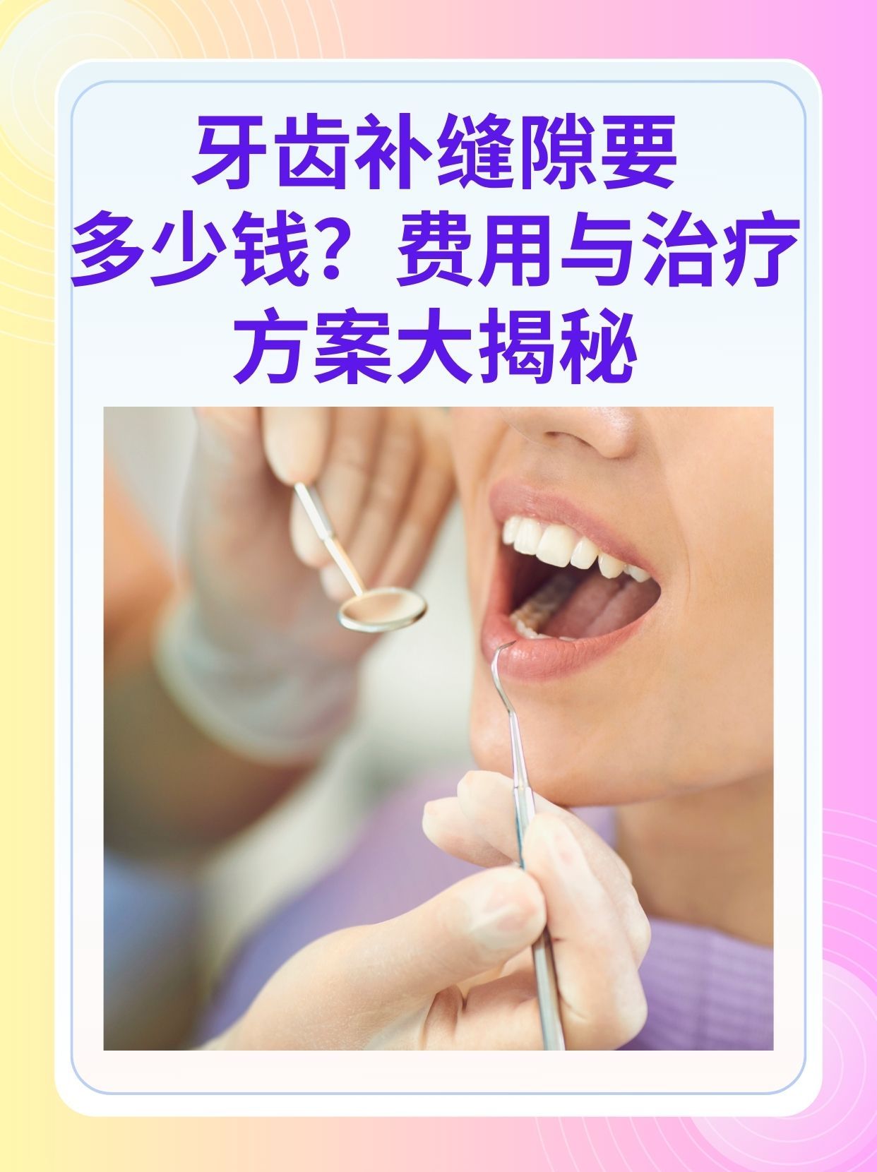 哈尔滨补牙医保可以报销吗(补牙医保可以报销吗 哪些可以报销呢)